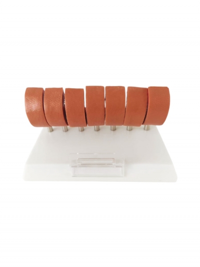 Разборная анатомическая модель атеросклероза сосуда Corpo de Atherosclerosis-4