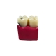 Стоматологическая модель зуба с кариесом и здоровым зубом Corpo Caries